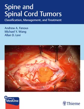 Fanous / Wang / Levi |  Spine and Spinal Cord Tumors | Buch |  Sack Fachmedien