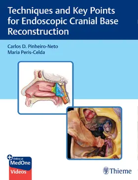 Pinheiro-Neto / Peris-Celda | Techniques and Key Points for Endoscopic Cranial Base Reconstruction | Medienkombination | 978-1-68420-232-4 | sack.de
