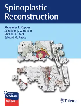 Ropper / Winocour / Bohl | Spinoplastic Reconstruction | E-Book | www.sack.de