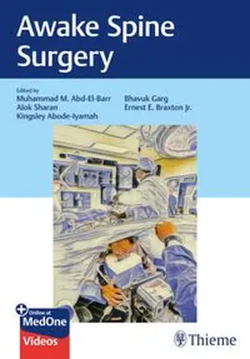 Abd-El-Barr / Sharan / Abode-Iyamah | Awake Spine Surgery | E-Book | www.sack.de