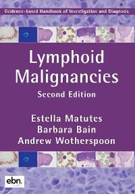 Matutes / Bain / Wotherspoon |  Lymphoid Malignancies | eBook | Sack Fachmedien