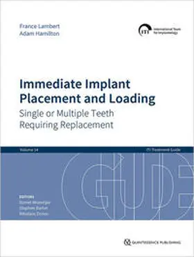 Wismeijer / Barter / Donos |  Immediate Implant Placement and Loading – Single or Multiple Teeth Requiring Replacement | Buch |  Sack Fachmedien