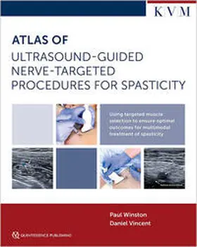 Winston / Vincent |  Atlas of Ultrasound-Guided Nerve-Targeted Procedures for Spasticity | Buch |  Sack Fachmedien