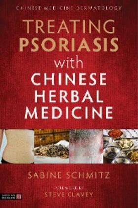 Schmitz | Treating Psoriasis with Chinese Herbal Medicine (Revised Edition) | E-Book | sack.de