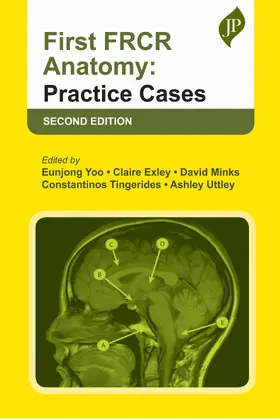 Uttley / Yoo / Exley |  First FRCR Anatomy | Buch |  Sack Fachmedien