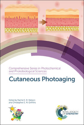 Watson / Griffiths | Cutaneous Photoaging | Buch | 978-1-78801-126-6 | sack.de