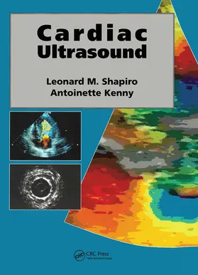 Shapiro |  Cardiac Ultrasound | Buch |  Sack Fachmedien
