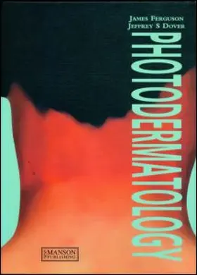 Ferguson / Dover |  Photodermatology | Buch |  Sack Fachmedien