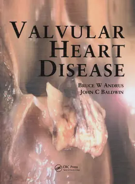 Andrus / Baldwin |  Valvular Heart Disease | Buch |  Sack Fachmedien