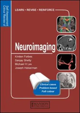 Forbes / Shetty / Lev | NEUROIMAGING | Buch | 978-1-84076-078-1 | sack.de