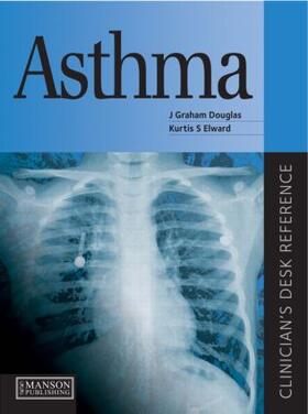 Douglas / Elward | ASTHMA | Buch | 978-1-84076-082-8 | sack.de