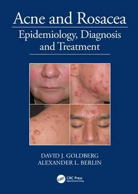 Goldberg / Berlin |  Acne and Rosacea | Buch |  Sack Fachmedien