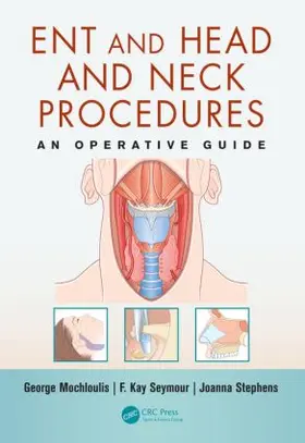 Mochloulis / Seymour / Stephens | Ent and Head and Neck Procedures | Buch | 978-1-84076-196-2 | www.sack.de