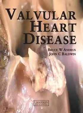 Andrus / Baldwin |  Valvular Heart Disease | eBook | Sack Fachmedien