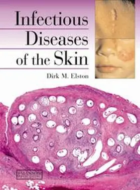 Elston | Infectious Diseases of the Skin | E-Book | www.sack.de