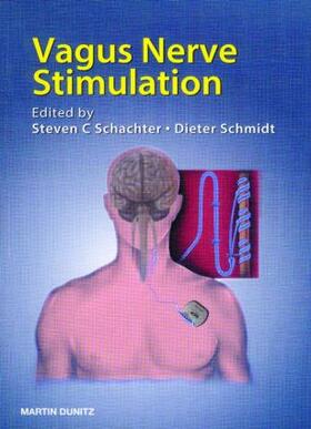 Schachter / Schmidt | Vagus Nerve Stimulation | Buch | 978-1-84184-257-8 | sack.de