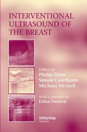 Drew / Cawthorn / Michell |  Interventional Ultrasound of the Breast | Buch |  Sack Fachmedien