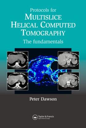 Peter | Protocols for Multislice Helical Computed Tomography | Buch | 978-1-84184-422-0 | sack.de