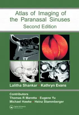 Shankar / Evans |  Atlas of Imaging of the Paranasal Sinuses, Second Edition | Buch |  Sack Fachmedien