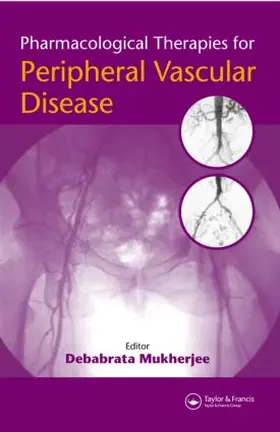Mukherjee |  Pharmacological Therapies for Peripheral Vascular Disease | Buch |  Sack Fachmedien