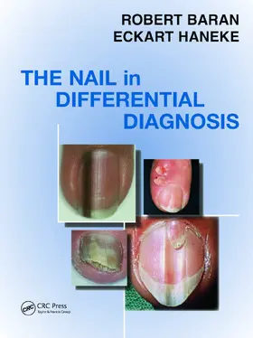 Baran / Haneke |  Nail in Differential Diagnosis | Buch |  Sack Fachmedien