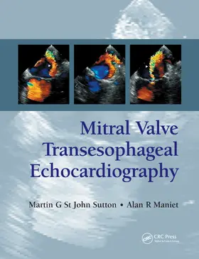 St. John Sutton / Maniet | Mitral Valve Transesophageal Echocardiography | Buch | 978-1-84184-608-8 | www.sack.de