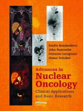 Bombardieri / Buscombe / Lucignani |  Advances in Nuclear Oncology: | Buch |  Sack Fachmedien