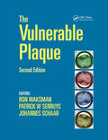Waksman / Serruys / Schaar |  Handbook of the Vulnerable Plaque | Buch |  Sack Fachmedien