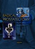 Kirby / Montorsi / Smith |  Radical Prostatectomy | Buch |  Sack Fachmedien