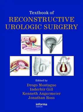 Montague / Gill / Ross |  Textbook of Reconstructive Urologic Surgery | Buch |  Sack Fachmedien