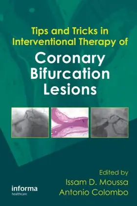 Moussa / Colombo |  Tips and Tricks in Interventional Therapy of Coronary Bifurcation Lesions | Buch |  Sack Fachmedien