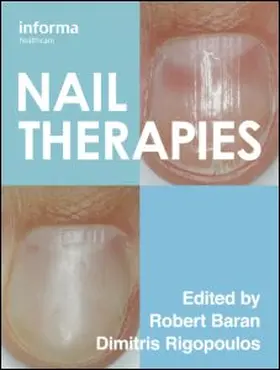 Baran / Rigopoulos |  Nail Therapies | Buch |  Sack Fachmedien