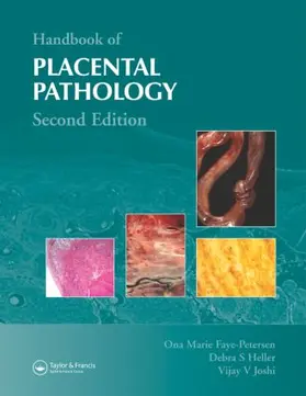 Faye-Petersen / Heller / Joshi | Handbook of Placental Pathology | Buch | 978-1-84214-232-5 | www.sack.de