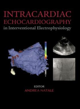 Natale |  Intracardiac Echocardiography in Interventional Electrophysiology | Buch |  Sack Fachmedien