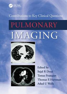 Desai / Franquet / Hartman | Pulmonary Imaging | Buch | sack.de