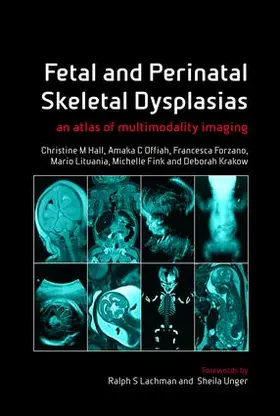 Hall / Offiah / Forzano |  Fetal and Perinatal Skeletal Dysplasias | Buch |  Sack Fachmedien