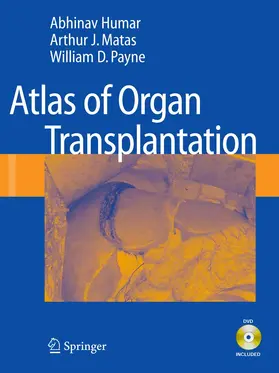 Humar / Matas / Payne |  Atlas of Organ Transplantation | eBook | Sack Fachmedien