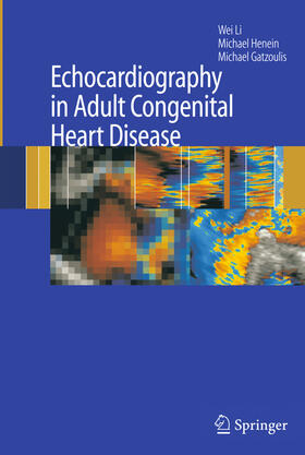 Li / Henein / Gatzoulis | Echocardiography in Adult Congenital Heart Disease | E-Book | sack.de