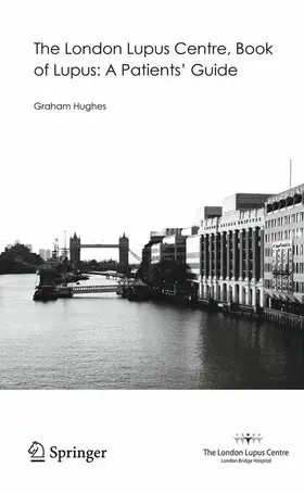 Hughes |  The London Lupus Centre, Book of Lupus: A Patients' Guide | Buch |  Sack Fachmedien