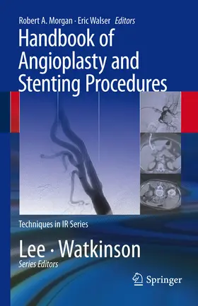 Morgan / Walser |  Handbook of Angioplasty and Stenting Procedures | eBook | Sack Fachmedien