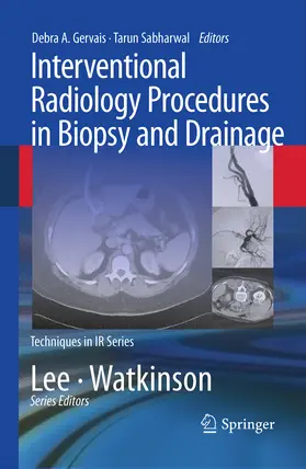 Sabharwal |  Interventional Radiology Procedures in Biopsy and Drainage | eBook | Sack Fachmedien