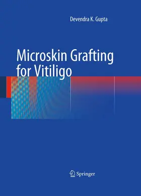 Gupta | Microskin Grafting for Vitiligo | E-Book | www.sack.de
