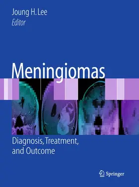 Lee | Meningiomas | Buch | 978-1-84882-910-7 | www.sack.de