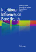 Burckhardt / Dawson-Hughes / Weaver |  Nutritional Influences on Bone Health | eBook | Sack Fachmedien