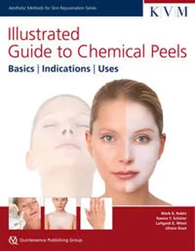 Rubin / Schürer / Wiest |  Illustrated Guide to Chemical Peels | Buch |  Sack Fachmedien