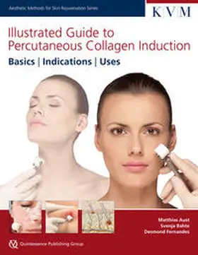 Aust / Bahte / Fernandes |  Illustrated Guide to Percutaneous Collagen Induction | Buch |  Sack Fachmedien