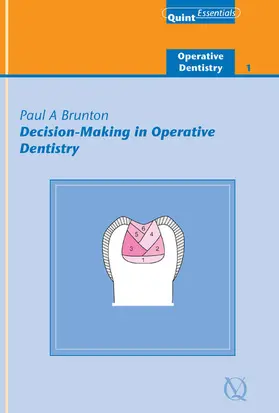Brunton |  Decision-Making in Operative Dentistry | eBook | Sack Fachmedien