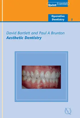 Bartlett / Brunton |  Aesthetic Dentistry | eBook | Sack Fachmedien