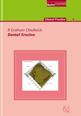 Chadwick |  Dental Erosion | eBook | Sack Fachmedien