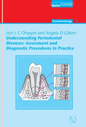 Chapple / Gilbert |  Understanding Periodontal Diseases: Assessment and Diagnostic Procedures in Practice | eBook | Sack Fachmedien
